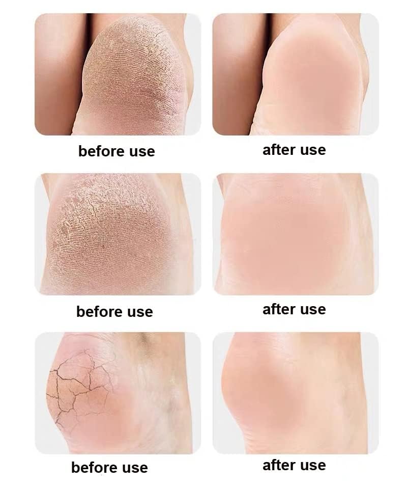 ZUCUR Moisturizing Silicone Gel Socks – Hydrating Spa Socks for Dry, Cracked Heels & Foot Care