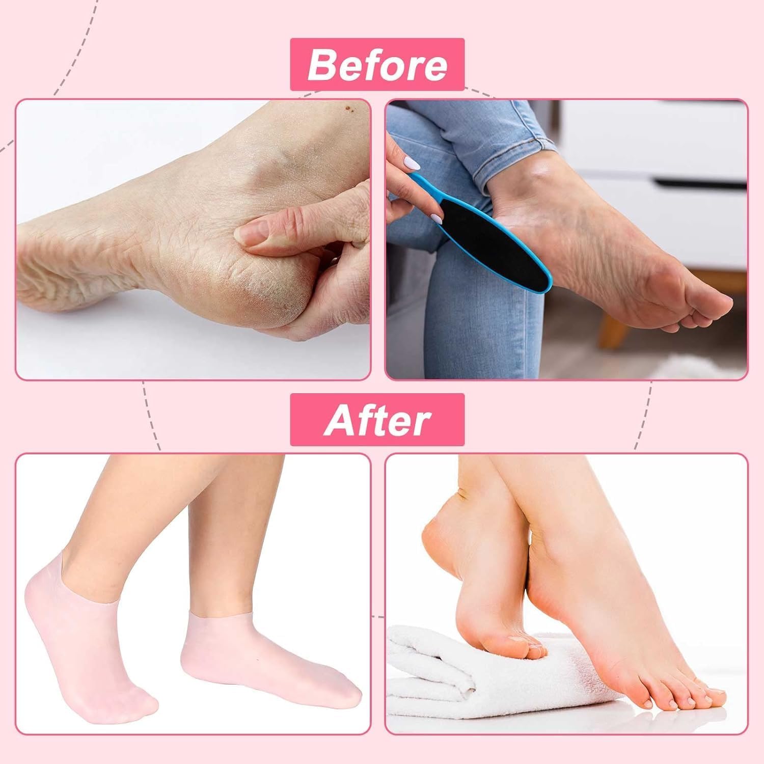 ZUCUR Moisturizing Silicone Gel Socks – Hydrating Spa Socks for Dry, Cracked Heels & Foot Care